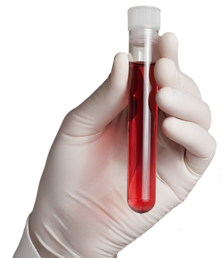 Person holding blood sample in test tube